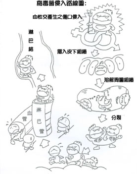 梅毒攻擊路線