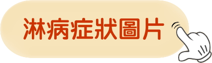 淋病尿道炎中醫