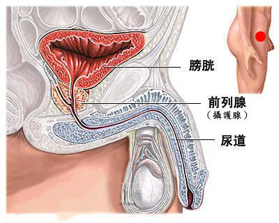 男性前列腺炎位置图片图片
