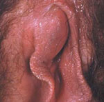 披衣菌圖示 披衣菌圖示